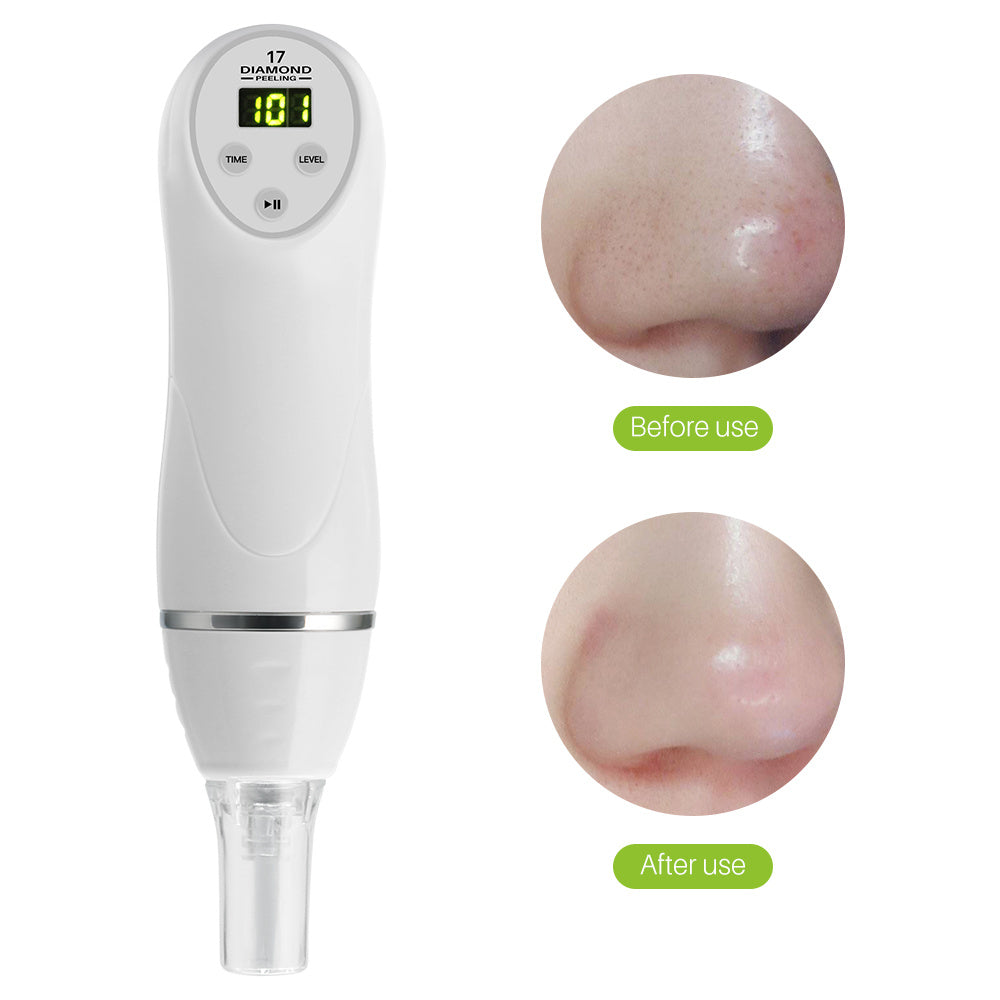 Electric pore suction acne removing device beauty cleaner